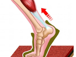 跟腱.jpg 跟腱.jpg