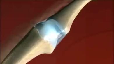 u=2107247830,201297307&fm=21&gp=0 u=2107247830,201297307&fm=21&gp=0